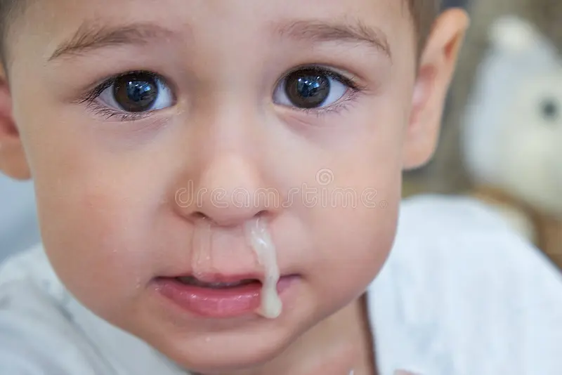 Young child experiencing a runny, mucus-filled nose